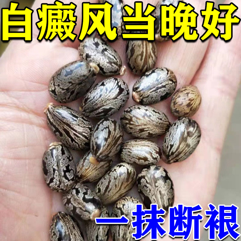 推荐白癜风外用黑色素生长外用快速消白斑药膏祛白斑汗斑花斑专门