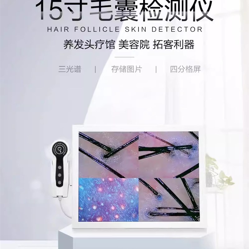 新款智能头皮检测仪毛囊高清四光谱多功能管理防脱养发馆毛发分析