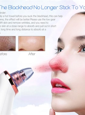 Pore-Cleaner Facial-Tools Face Cleansing Blackhead-Remover S