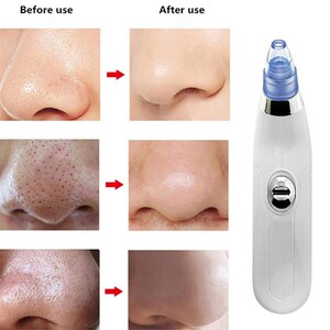 Acne Pimple Clean-Skin-Tool Removal-Face Blackhead-Remover D