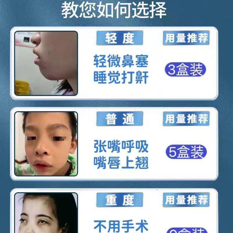热销儿童张嘴呼吸不通气腺样相体肥大中药儿童嘴贴面容纠正矫正器