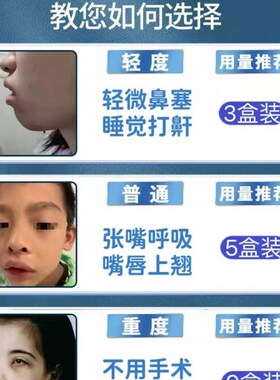 热销儿童张嘴呼吸不通气腺样相体肥大中药儿童嘴贴面容纠正矫正器
