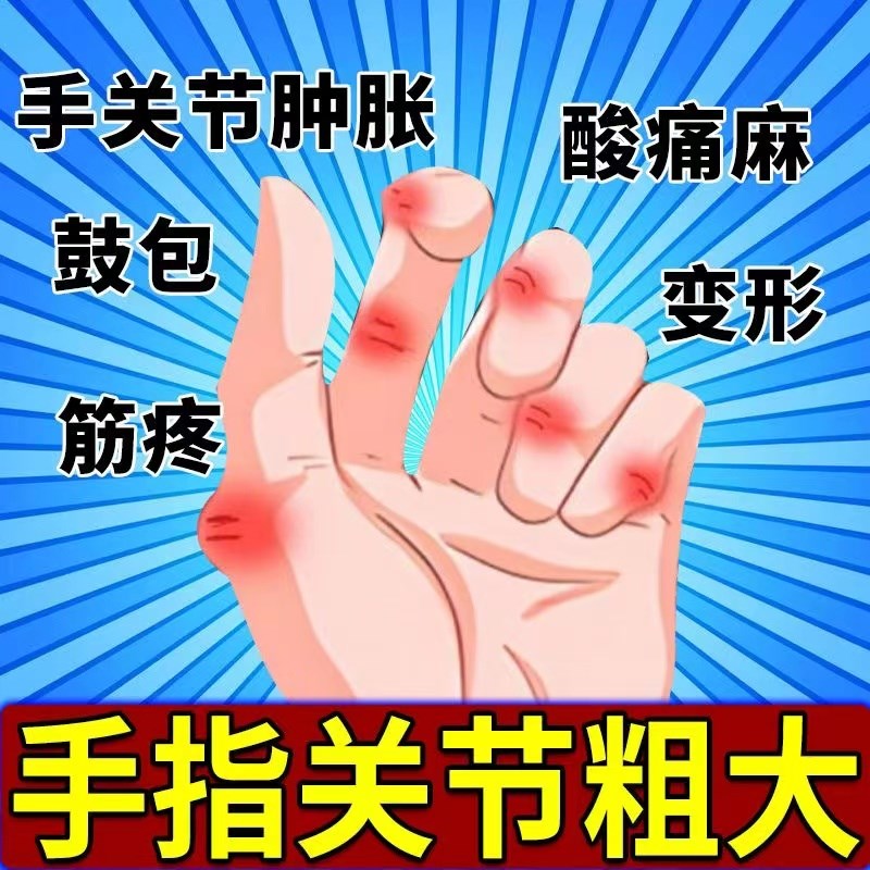 正品腱鞘焱专用软膏关节痛凝胶手腕F扭伤止痛手指鼓包麻木弹响抑
