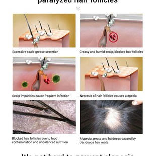 Serum Hair Loss Essence Liquid护发素 Growth