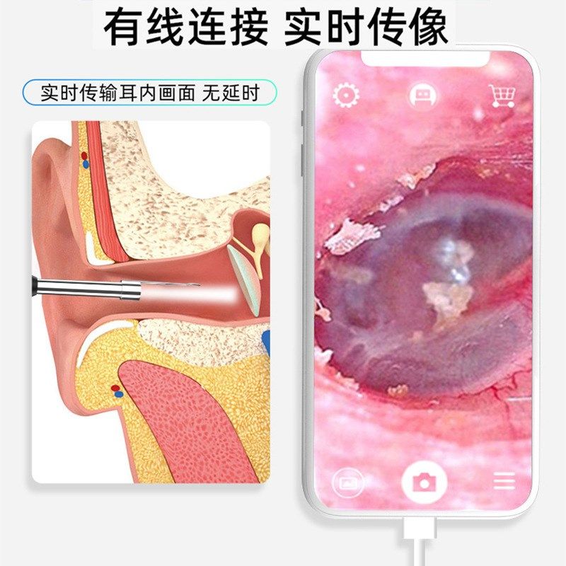 type-c高清可视n耳勺内窥镜耳朵清洁器掏耳镜挖耳勺采耳工具仪神,电子/电工,内窥镜摄像头,淘宝优惠券,粉丝福利购,淘宝优惠卷