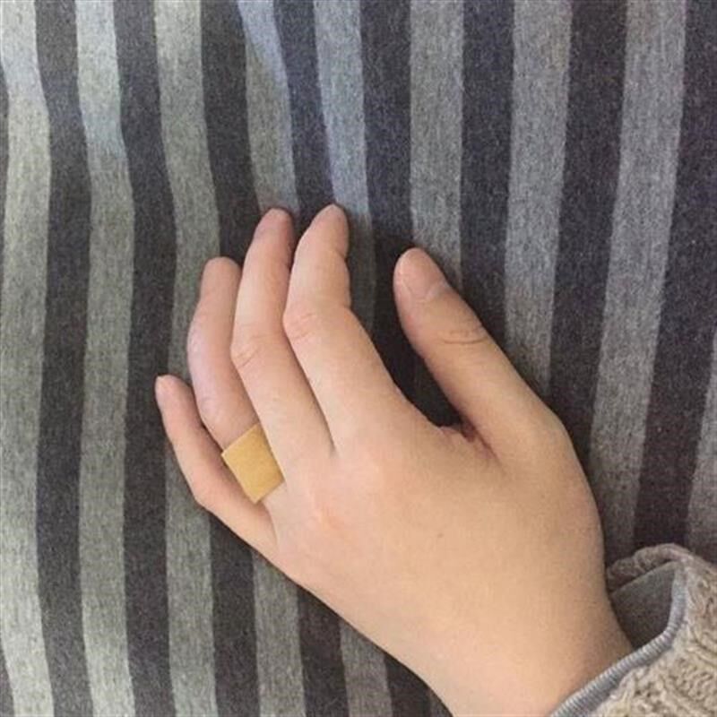 假手指套身心障碍人士硬定制半手套指义假肢电手臂套进甲皮矽胶指