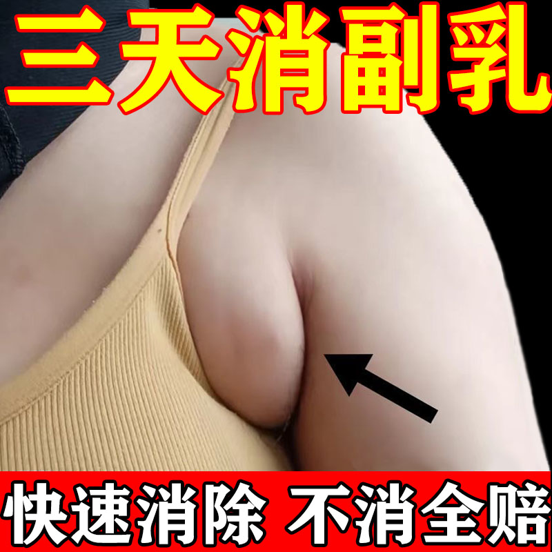 热销【三天必消】副乳消除贴疏通腋下淋巴结肿痛收巨大副乳专用散