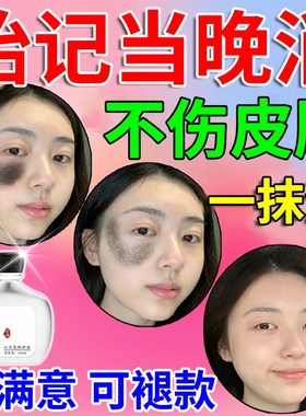 胎记去除神器脸部祛天生胎记咖啡斑黑F红色素快速淡化消除太田痣