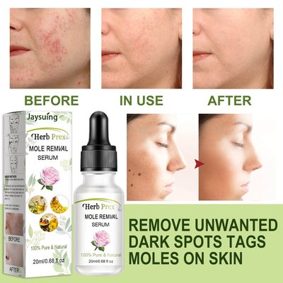 极速20ml New Spot Mole Face Serum Essence Oil Whitening Brig