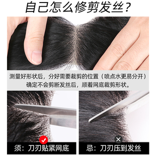 疤痕补发贴头顶秃斑伤痕秃顶专用假发贴J片真人发丝生物头皮男女