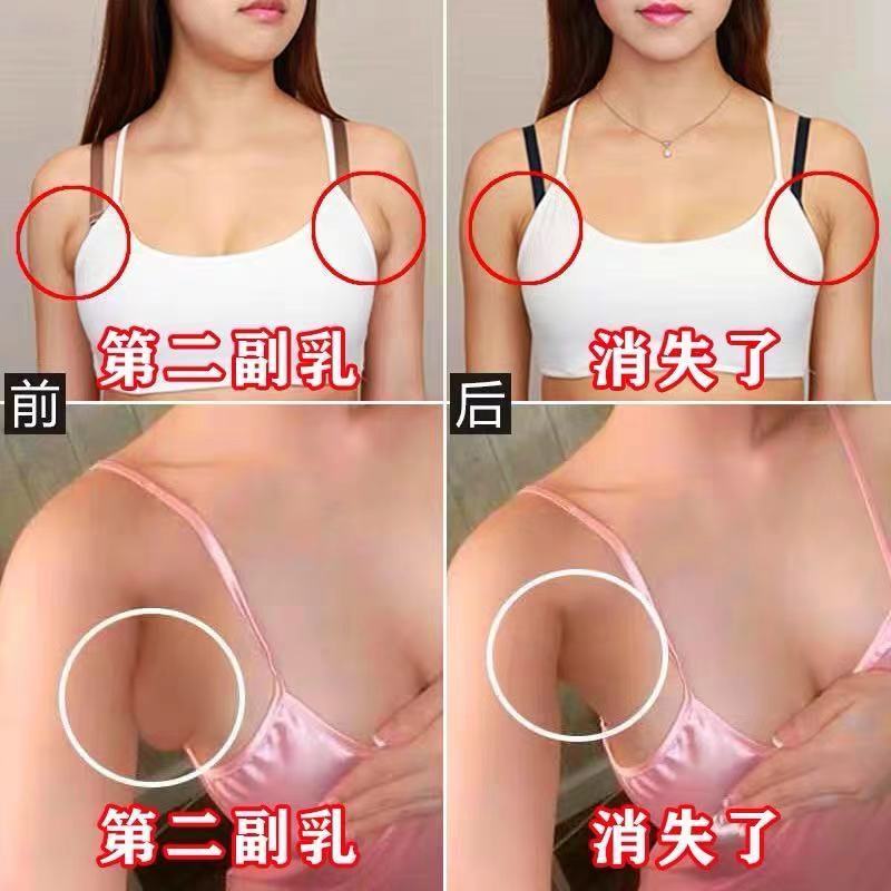 工厂销副乳去副乳神器淋巴结节颈C部肿大甲状腺疏通腋下淋巴肿大