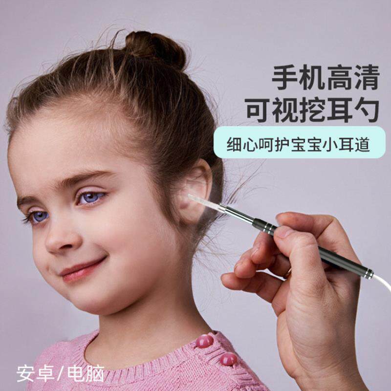 可视采耳仪器可是耳镜掏耳勺掏耳朵手机I内窥镜探头儿童耳道内视