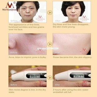 hyaluronic acid repa skin serum pureplant 速发Snail extract