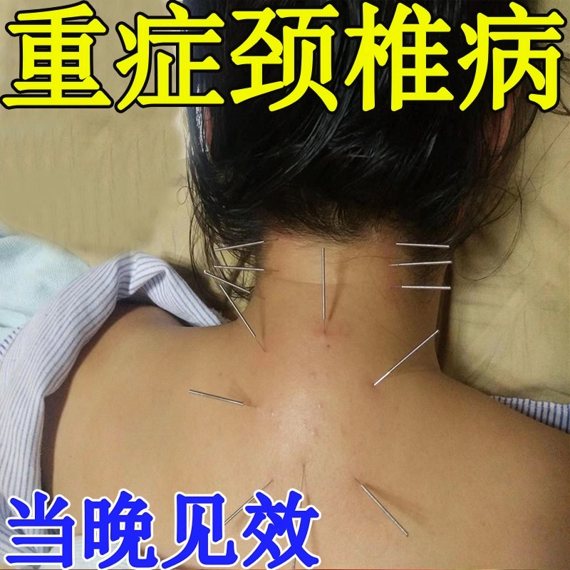 热销颈椎疼一夜消】颈椎贴颈椎病专用贴颈椎疼痛僵硬转头困难特效