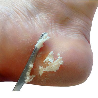 速发1 pc Professional Foot Scraper Stainless Steel Foot Care