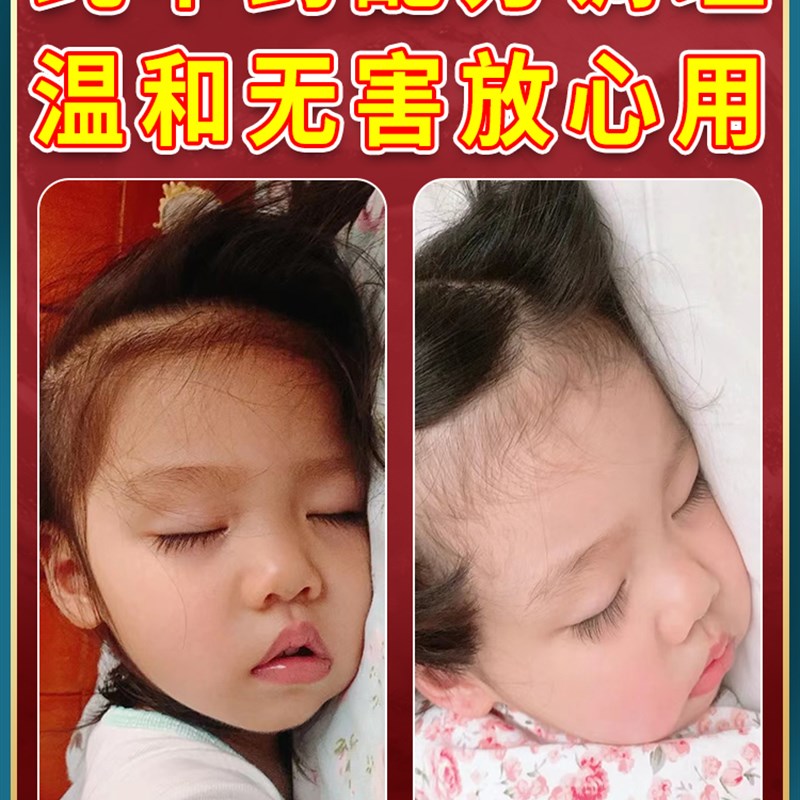 工厂销去裉】儿i童腺样体肥大克星面容矫正器嘴突鼻塞打呼噜调理