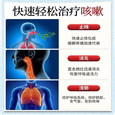 速发咳嗽止咳化痰喉咙痒干咳嗽嗓子干咳久咳无痰小孩止咳贴成人特