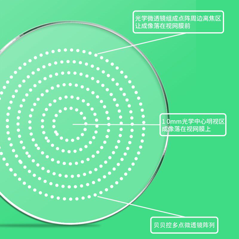 多点离焦防控近视眼镜片缓解控制儿童青少年度数长加镜片