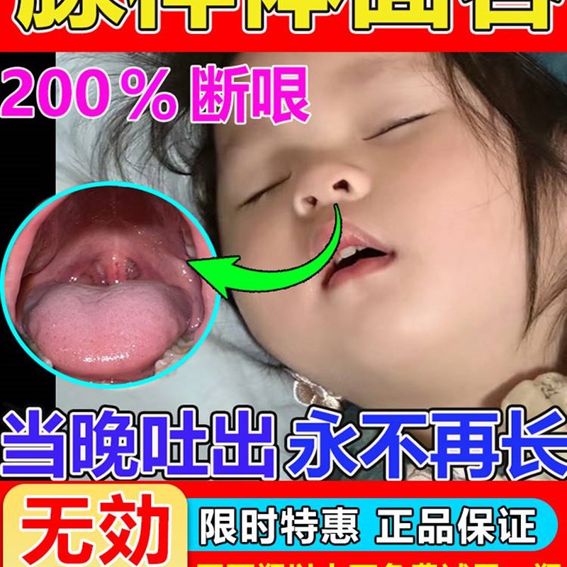 热销腺样体肥大调理儿童宝宝面容矫正器不通气中药贴嘴贴鼻塞张嘴