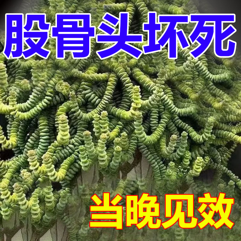 热销【一贴止痛】股骨头髋关节疼痛缺血坏死肿胀疼痛股骨头坏死专