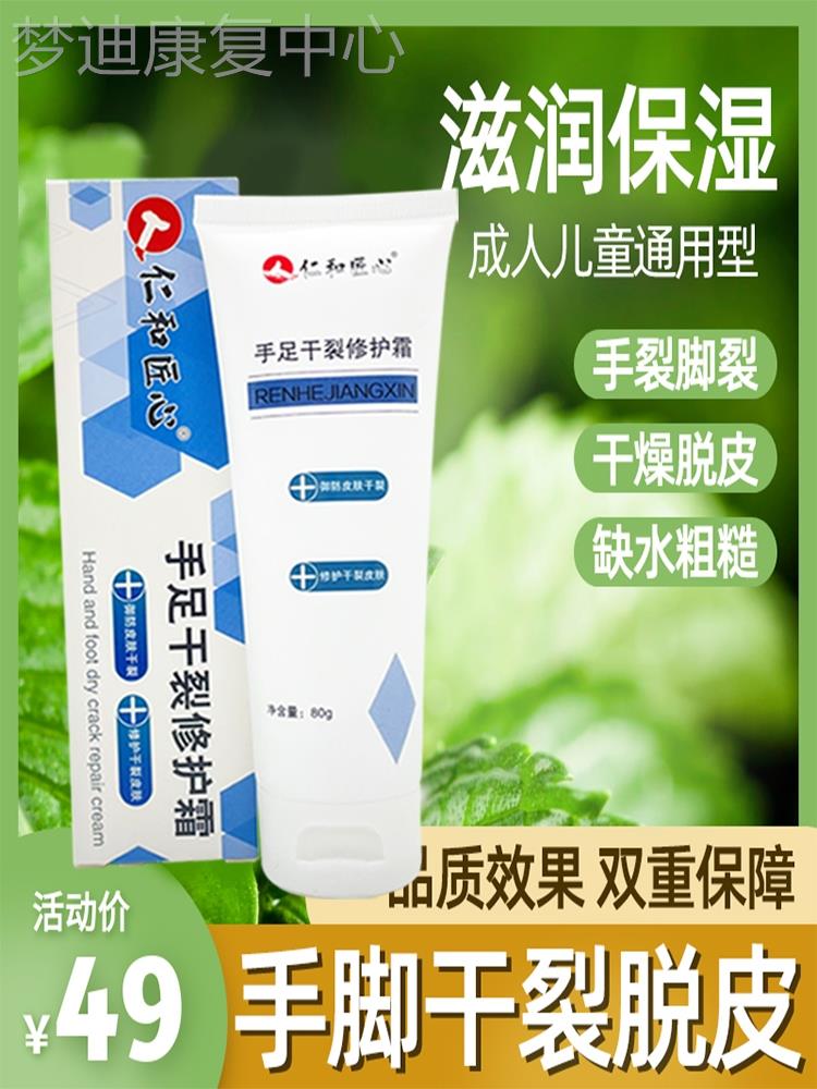 手痒止痒膏头皮真菌感染手癣膏脱皮干裂真菌感染真菌感染手鹅掌风-封面