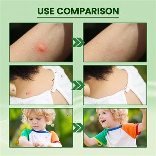 Anti itching Soothing 新品 Red Repel Mosquito Ointment Dot