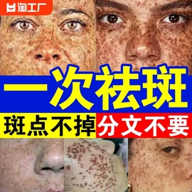 点斑祛斑专用药水精华液分解黑色素去黄褐斑雀斑老年斑无痕