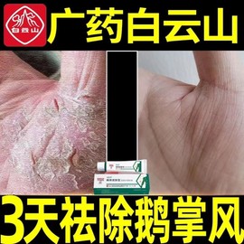 鹅掌风特效脚手癣干裂脱皮真菌感染手部外用止痒抑菌膏专用药药膏