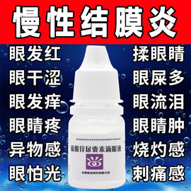 过敏性结膜炎眼药水慢性滴眼液治疗沙眼缓解抗视疲劳模糊去红血丝