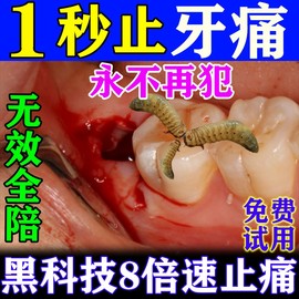 牙疼牙痛止疼药速效虫牙蛀牙，牙龈肿痛杀死牙神经神器特效喷雾剂li