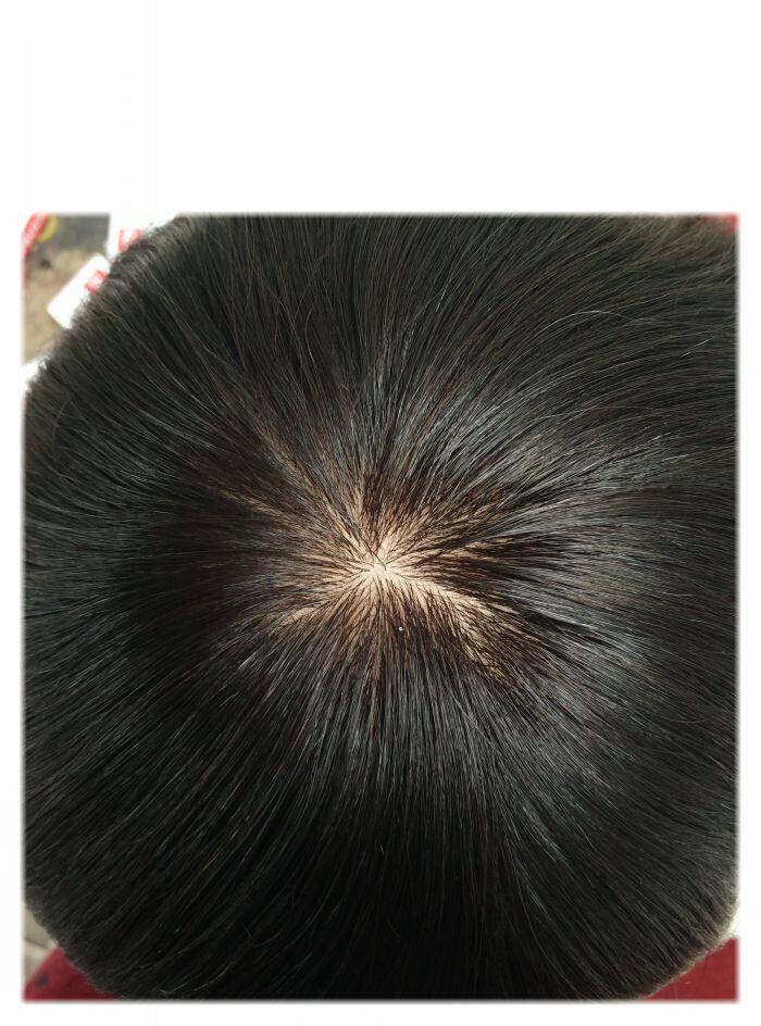 Extension mèches - Ref 224311 Image 1