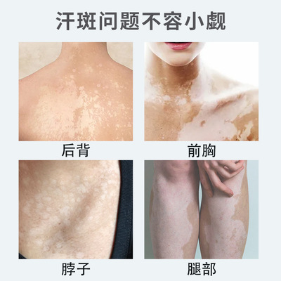 汗斑专用汗斑净汉斑香露花斑膏非药皮肤外用去汗斑喷雾剂皂