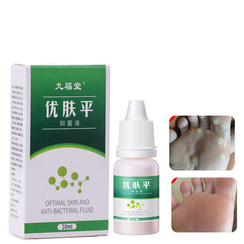 九福堂优肤平鸡眼膏跖疣瘊刺老茧扁平克疣液滴液