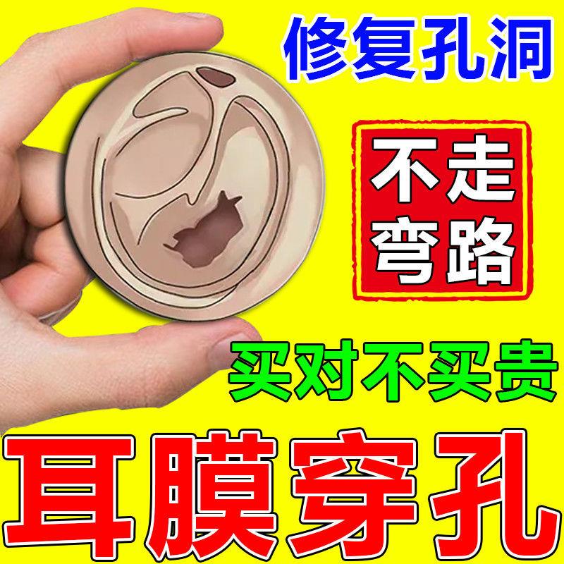 无痛修复】耳膜穿孔鼓膜有洞中耳炎耳朵发炎感染疼痛听力下降抑菌