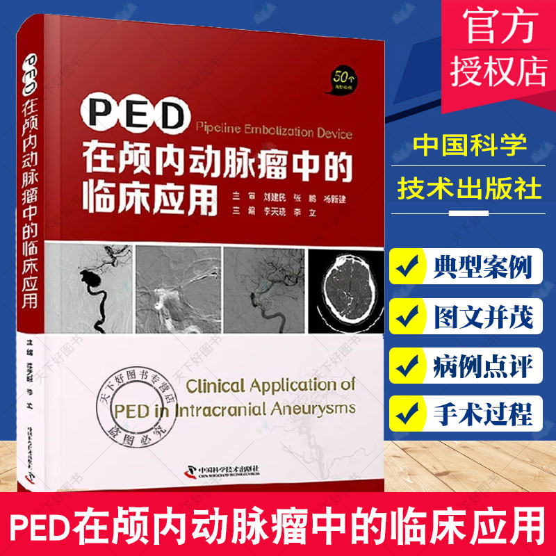 正版 PED在颅内动脉瘤中的临床应用 50个经典案例 李晓天 李立 主编 脑实质出血 Pipeline并发症 中国科学技术出版社9787504690