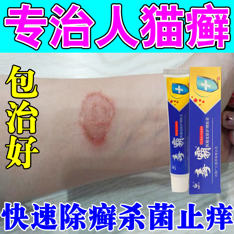 治疗猫癣专用药人用人得铜钱癣人传染了猫藓长红斑脱皮湿疹止痒膏
