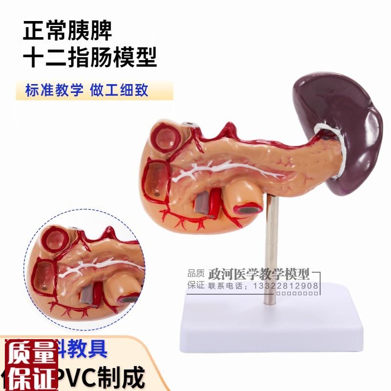 人体肝脏脾胰解剖模型消v化系统模型腹腔干肝门静脉正常肝胰模