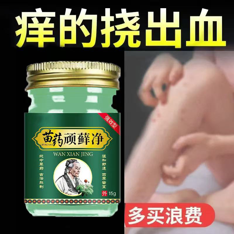 苗药顽癣净牛皮癣银屑湿疹头癣体癣股癣手足癣皮肤瘙痒止痒癣膏