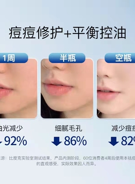 比度克祛痘爽肤水控油润肤缩毛孔
