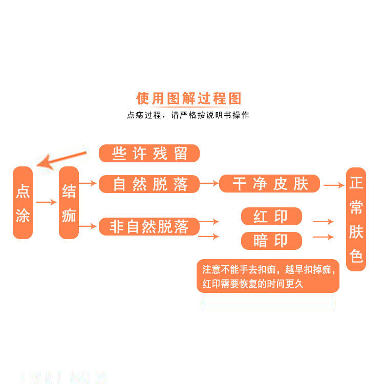 点黑痣膏无痣痕脸部家用正品美容院专用仪器去黑点神器祛肉痣药水