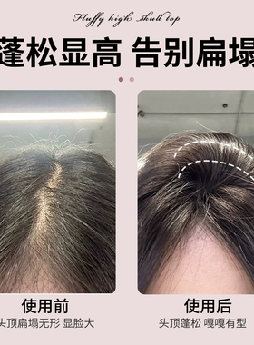 高颅顶神器发根固定夹