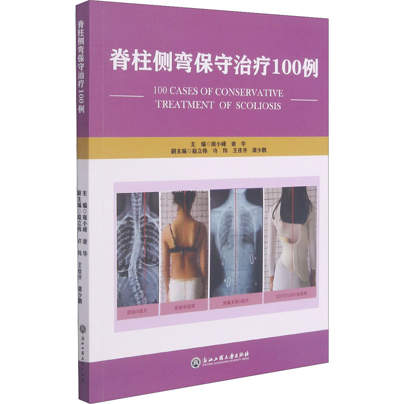 【新华文轩】脊柱侧弯保守治疗100例 正版书籍 新华书店旗舰店文轩官网 浙江工商大学出版社 - 图3