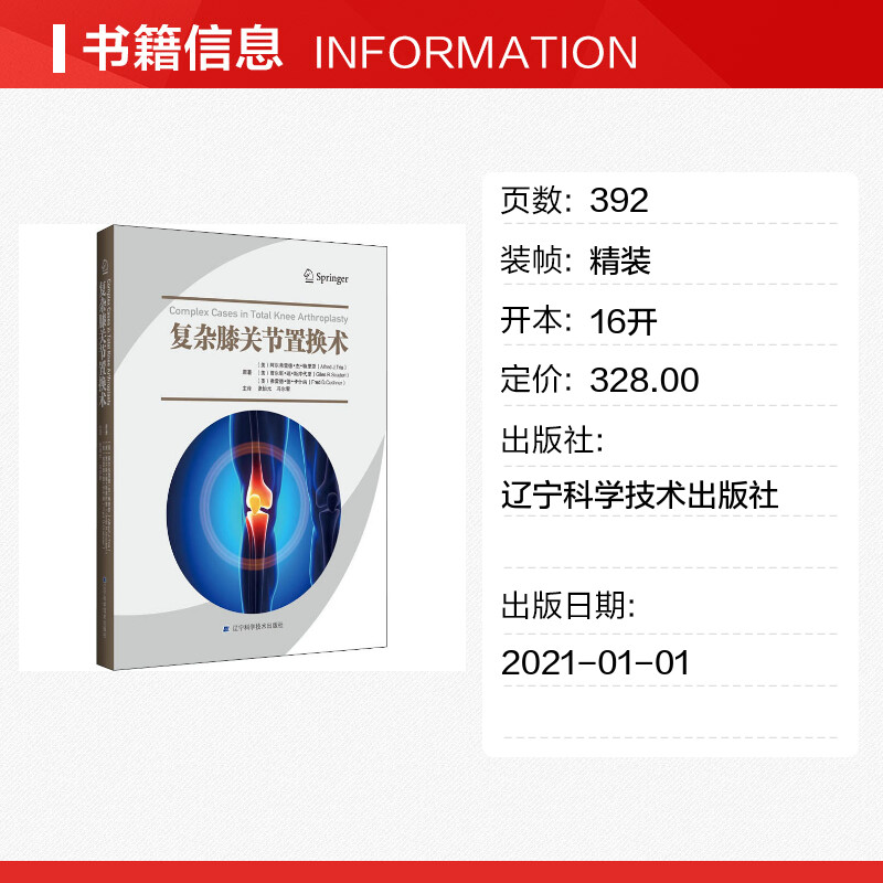 【新华文轩】复杂膝关节置换术 (美)阿尔弗雷德·杰·特里亚,(美)贾尔斯·瑞·斯库代里,(美)弗雷德·德·卡什纳 - 图0