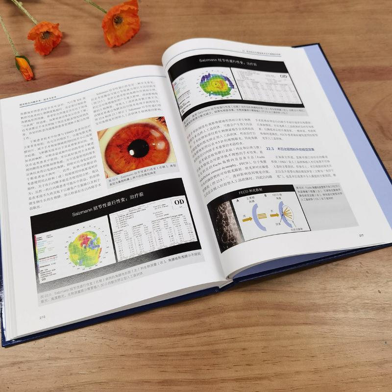 屈光性白内障手术 技术与艺术 正版书籍 屈光性白内障手术治疗著作 屈光性白内障手术教材 适合白内障手术医师和眼科住院医师阅读 - 图1