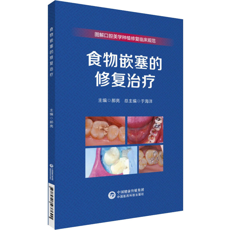 食物嵌塞的修复治疗 图解口腔美学种植修复临床规范口腔种植规范化治疗食物嵌塞临床及影像学检查治疗充填修复治疗病例分析正版书 - 图3