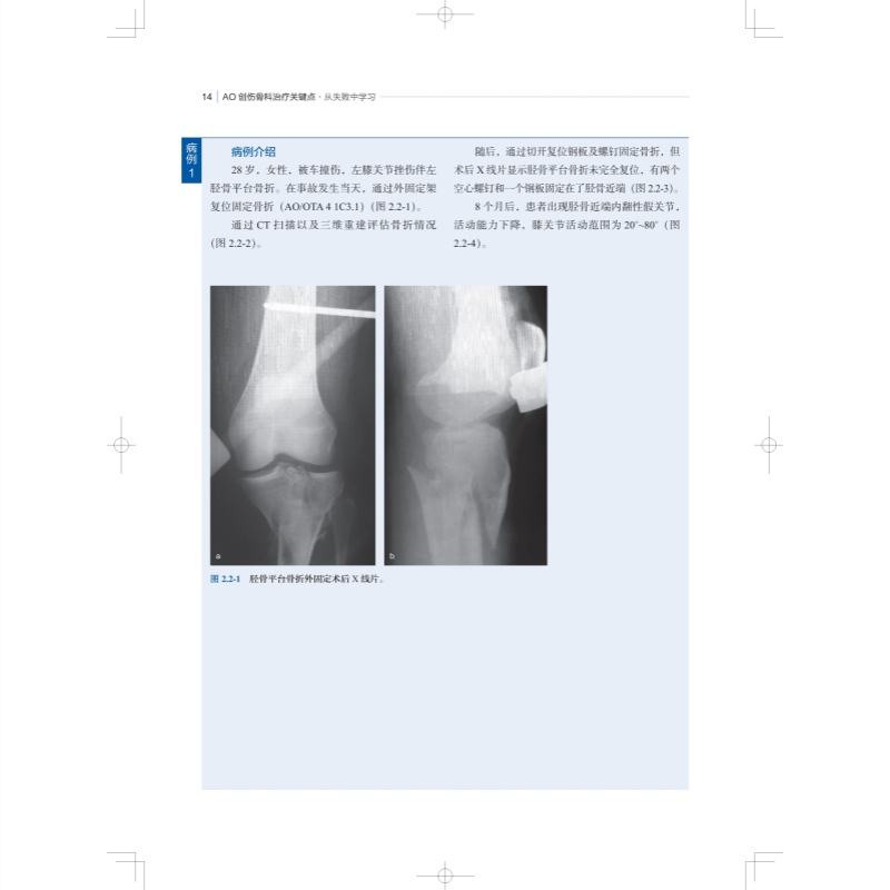 AO创伤骨科治疗关键点 从失败中学习骨损伤治疗上海科学技术出版社外科学骨科医师创伤外科医生医学工具指南书 - 图3