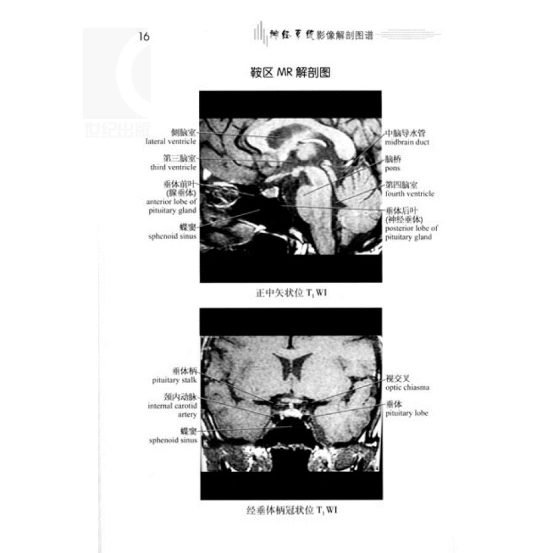 神经系统影像解剖图谱/医学影像学解剖图谱丛书李克入门读物西医医学医药卫生上海科技世纪出版-图2