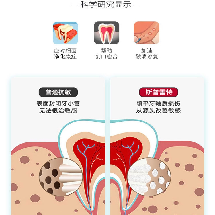 俄罗斯进口斯普雷特splat牙膏抗敏感清新口气固齿美白去牙渍口臭 - 图1