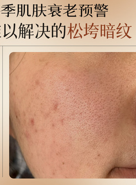 宫佩黄芪抗皱紧致水乳