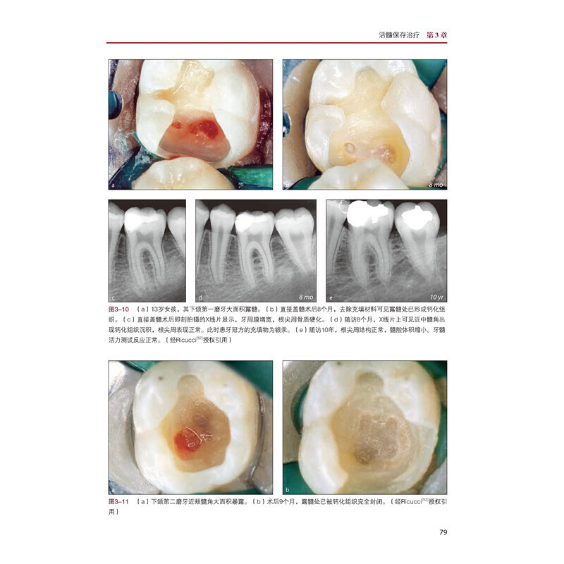 牙髓病学——生物学与临床视角 - 图2